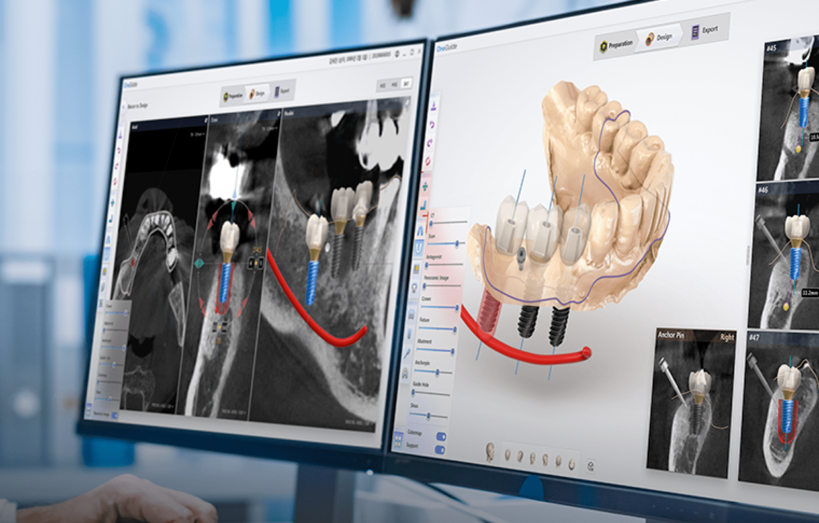 Odontología Digital